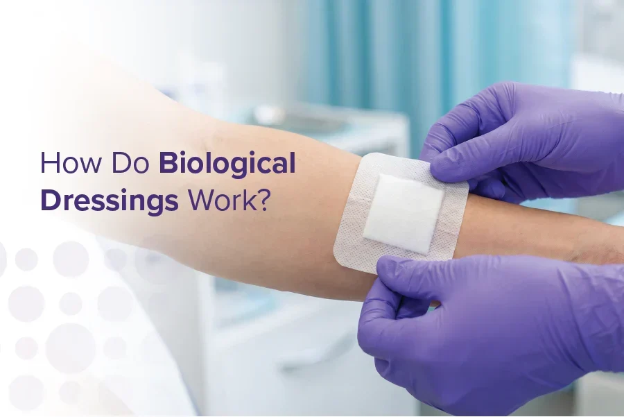 What Is Biological Dressing?