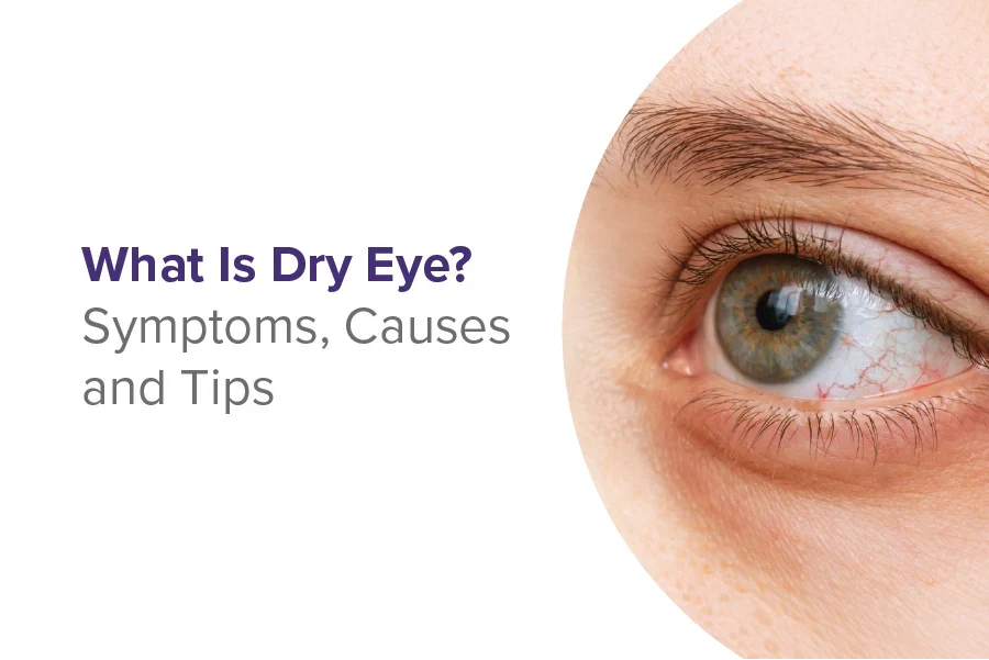 Dry Eyes: Types, Symptoms, Causes & Treatment