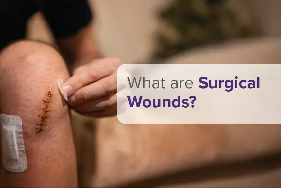 Surgical Wounds Explained: Types, Risks, and Recovery