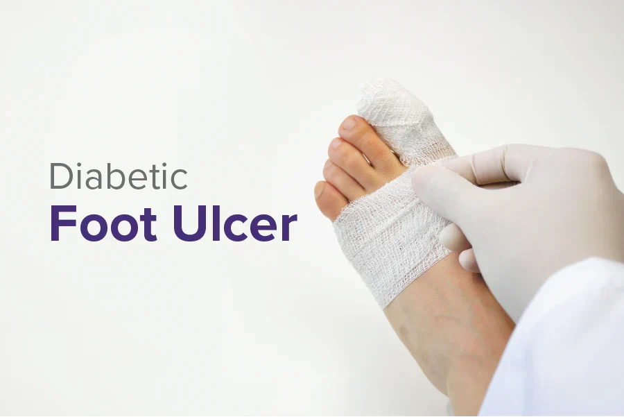 Randomised Trial Results: dHAICM vs Standard Care in Diabetic Foot Ulcer Treatment