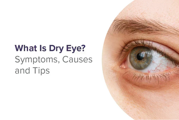 Dry Eyes: Types, Symptoms, Causes & Treatment