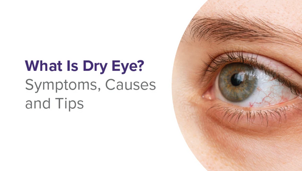 Dry Eyes: Types, Symptoms, Causes & Treatment