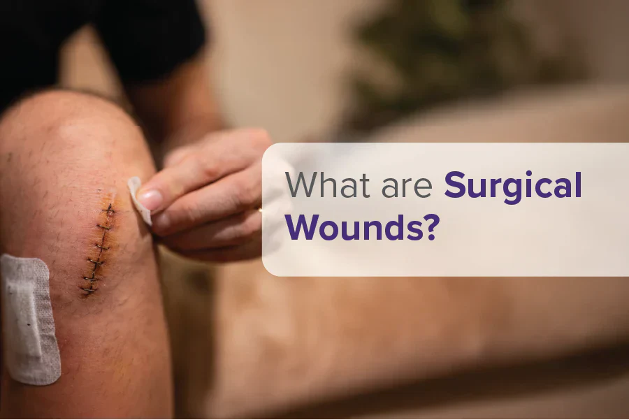 Surgical Wounds Explained: Types, Risks, and Recovery