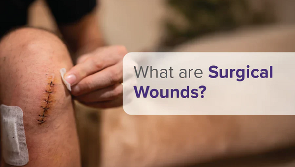 Surgical Wounds Explained: Types, Risks, and Recovery
