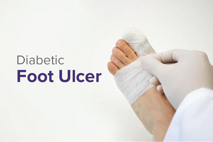 Randomised Trial Results: dHAICM vs Standard Care in Diabetic Foot Ulcer Treatment