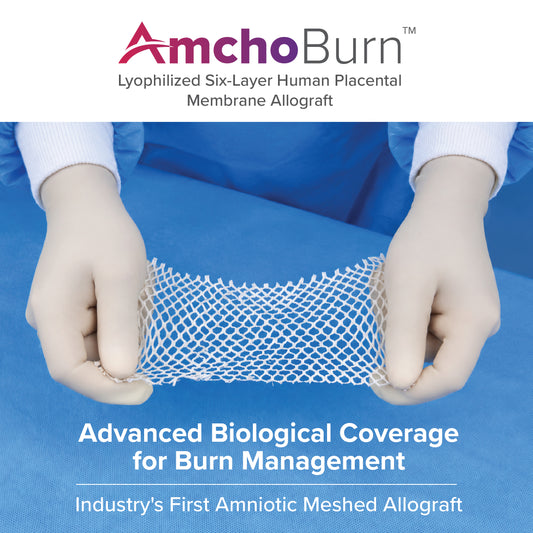 AmchoBurn