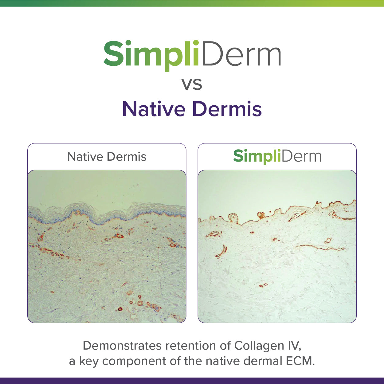 SimpliDerm