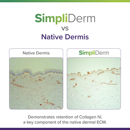 SimpliDerm