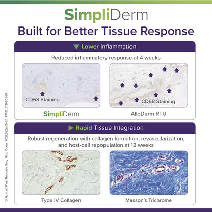 SimpliDerm
